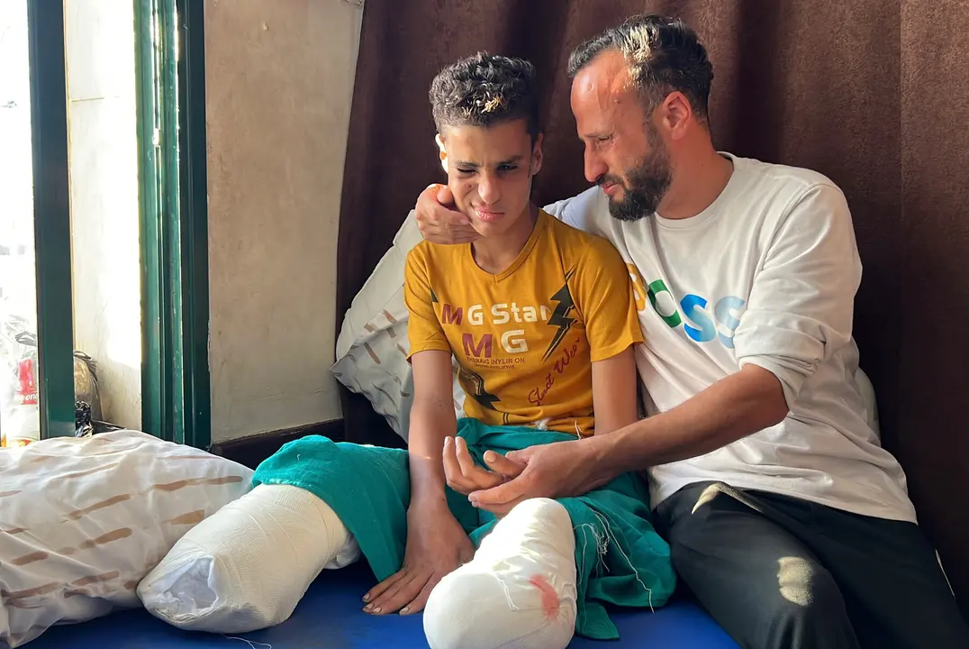 El ni&ntilde;o palestino Muhammad Sarour recibe atenci&oacute;n m&eacute;dica en el Hospital de los M&aacute;rtires de Al-Aqsa, en Deir al-Balah, en la zona central de la Franja de Gaza, el 2 de junio de 2026. Sarour sufri&oacute; la amputaci&oacute;n de ambas piernas, perdi&oacute; el ojo izquierdo y padece par&aacute;lisis en la mano izquierda tras resultar herido en una explosi&oacute;n provocada por munici&oacute;n sin detonar. Su familia est&aacute; solicitando permiso para trasladarlo al extranjero con el fin de que reciba tratamiento especializado - Youssef Abu Watfa / APA Images.