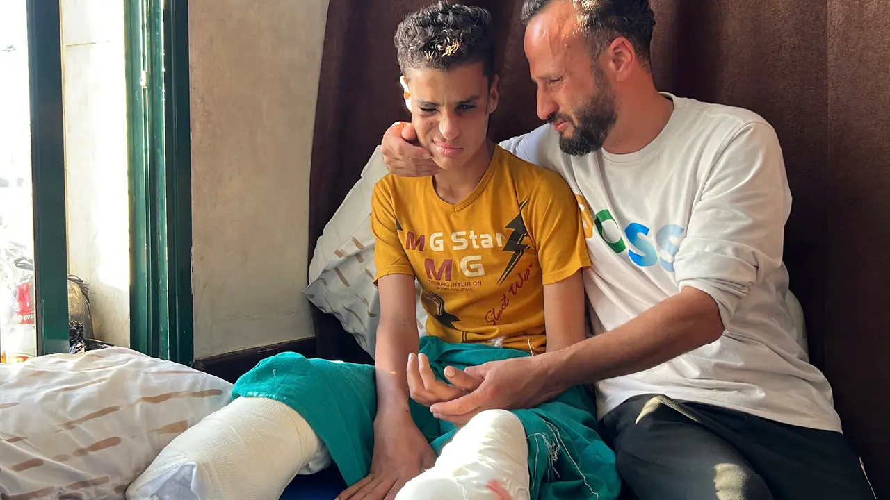 El ni&ntilde;o palestino Muhammad Sarour recibe atenci&oacute;n m&eacute;dica en el Hospital de los M&aacute;rtires de Al-Aqsa, en Deir al-Balah, en la zona central de la Franja de Gaza, el 2 de junio de 2026. Sarour sufri&oacute; la amputaci&oacute;n de ambas piernas, perdi&oacute; el ojo izquierdo y padece par&aacute;lisis en la mano izquierda tras resultar herido en una explosi&oacute;n provocada por munici&oacute;n sin detonar. Su familia est&aacute; solicitando permiso para trasladarlo al extranjero con el fin de que reciba tratamiento especializado - Youssef Abu Watfa / APA Images.